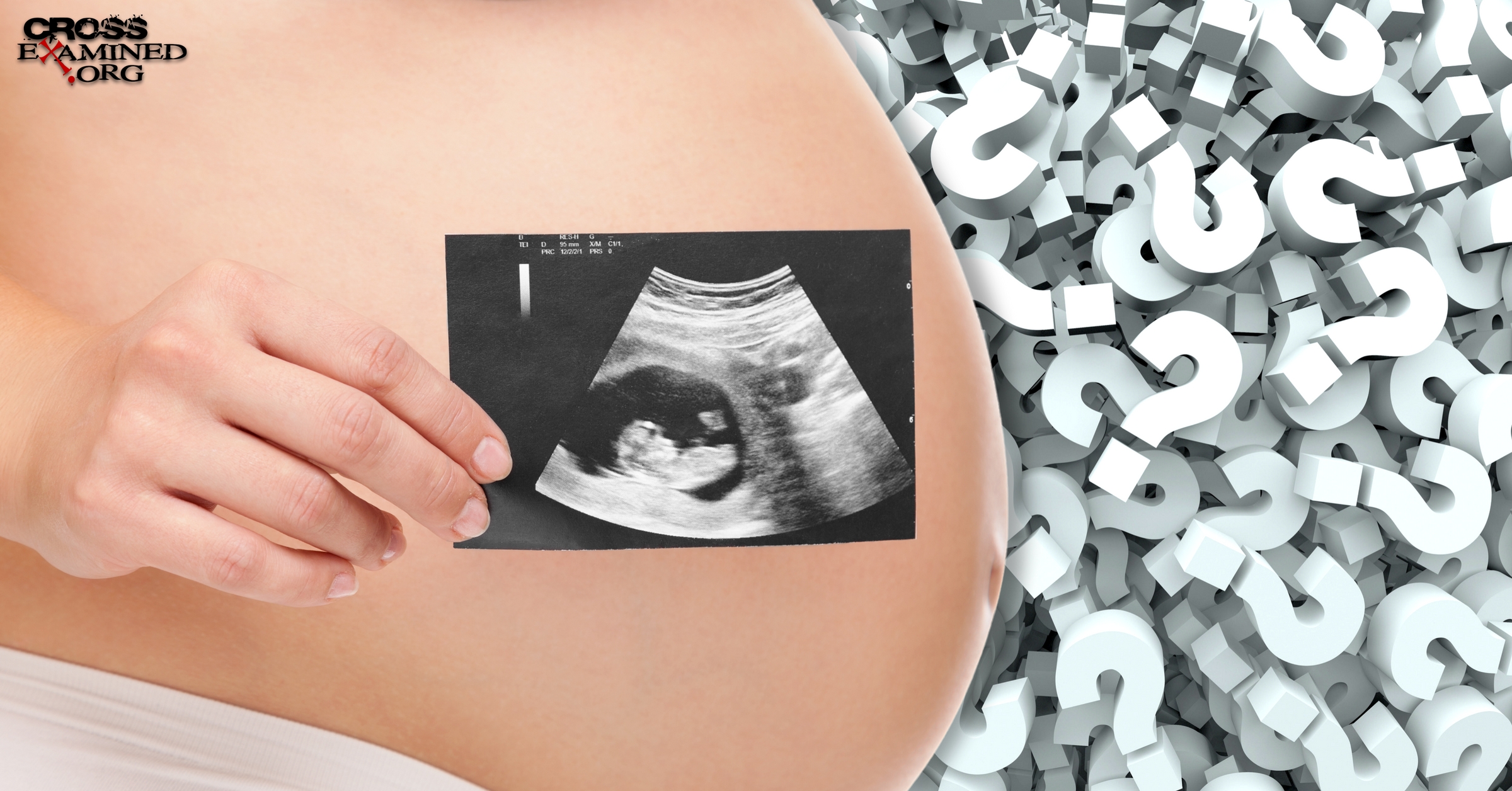 Unborn Abortion Life