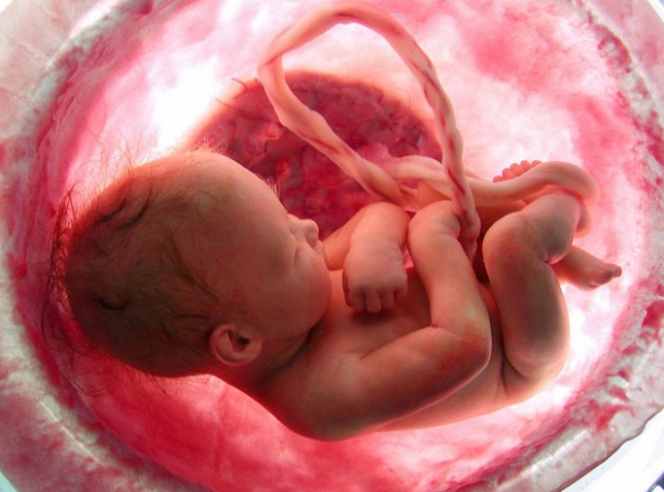Why Doesn’t Everyone See Late-Term Abortions as Morally Wrong?